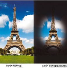 Glaucoma